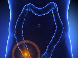 Những điều cần biết về viêm ruột thừa