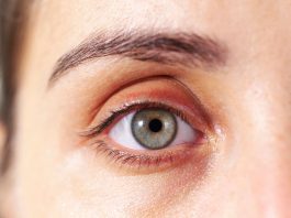 Những biểu hiện ở mắt cho thấy sức khỏe bạn đang có vấn đề